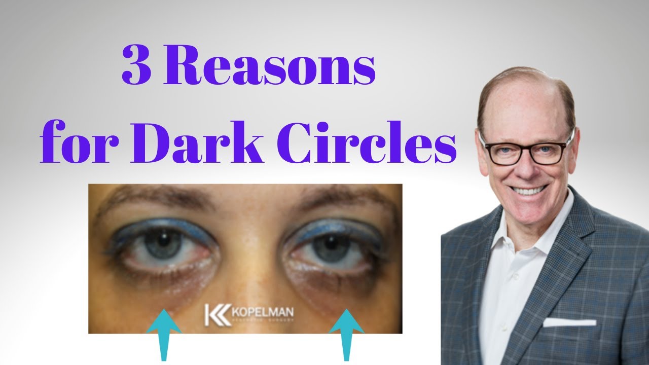 3 Reasons for Dark Circles Under Your Eyes | Facial Plastic Surgeon Insight