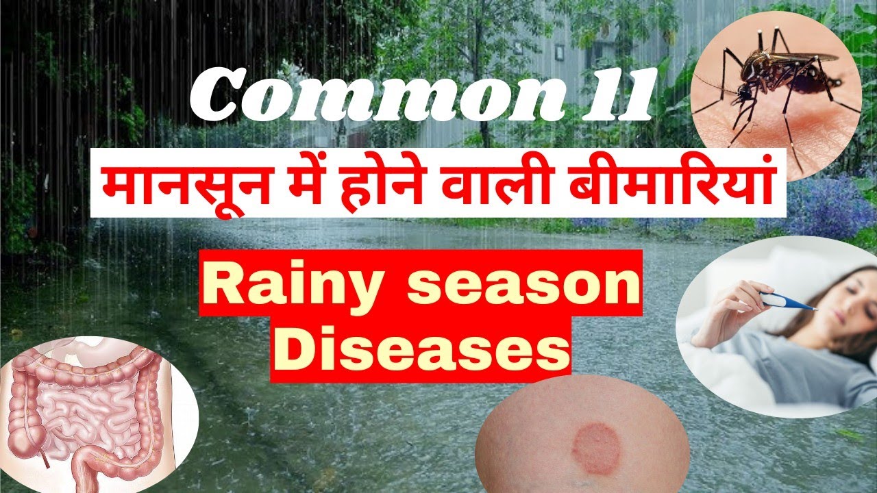 मानसून में बीमारी | rainy season diseases | Common monsoon diseases | mansoon diseases