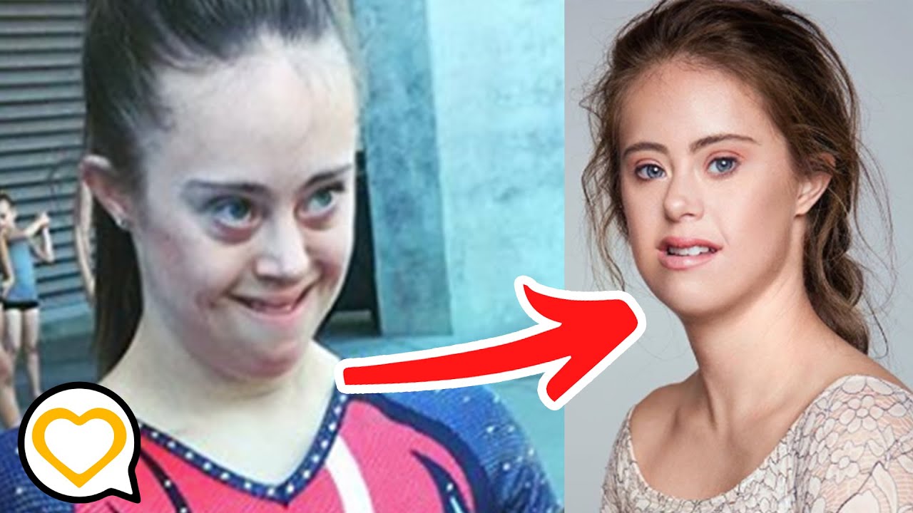 From Special Olympics Gymnast To High Fashion Model