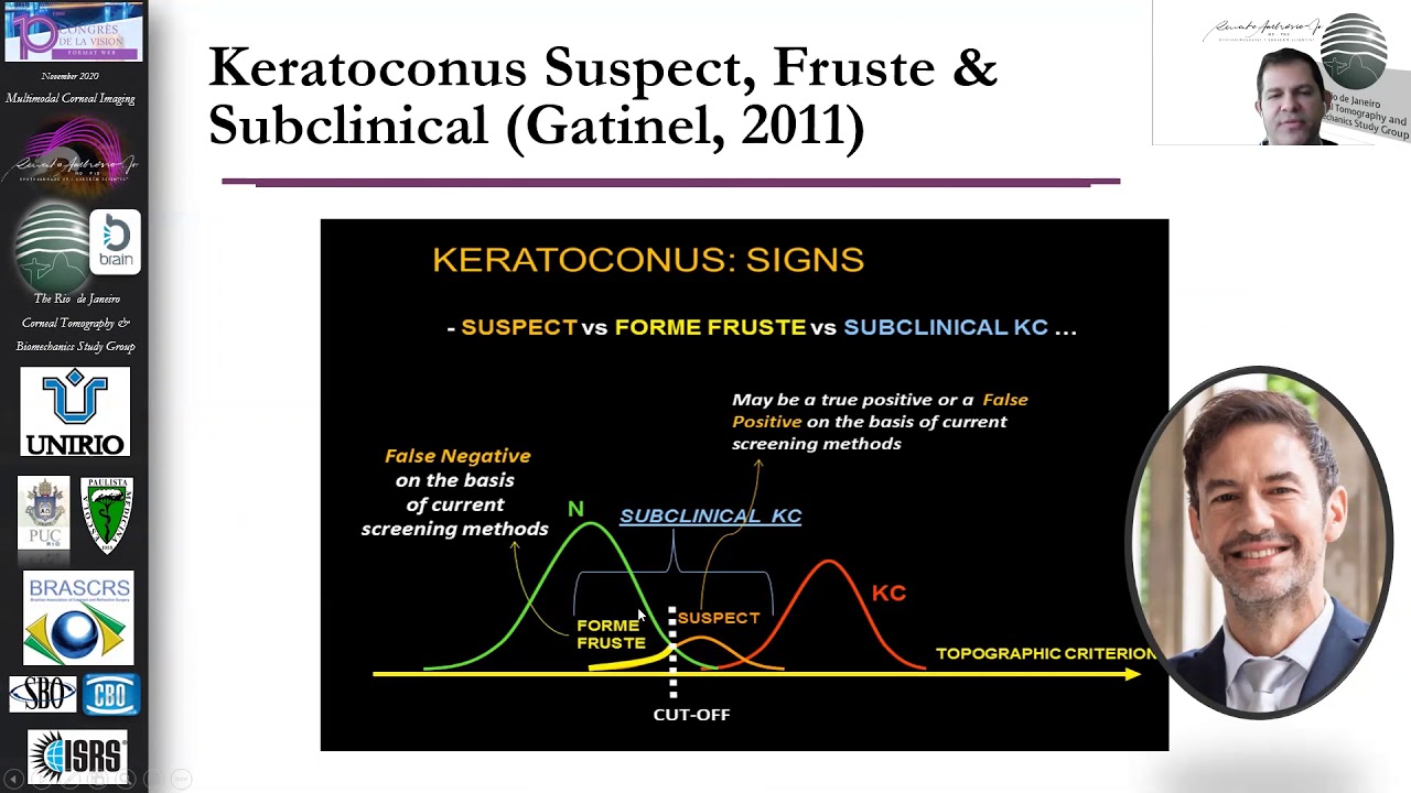 Corneal Tomography and Biomechanics  | R. Ambrosio