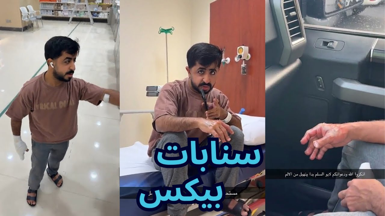 سنابات بيكس ايش صار على يد دحوم؟ | 26 فبراير 