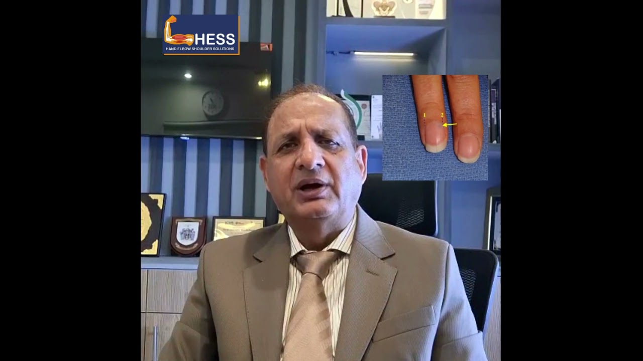 Tumor Of Finger | انگلی کا ٹیومر: درد کی اصل وجہ کیا ہے؟ | By Brig. Dr. khalid Masood | Urdu/Hindi
