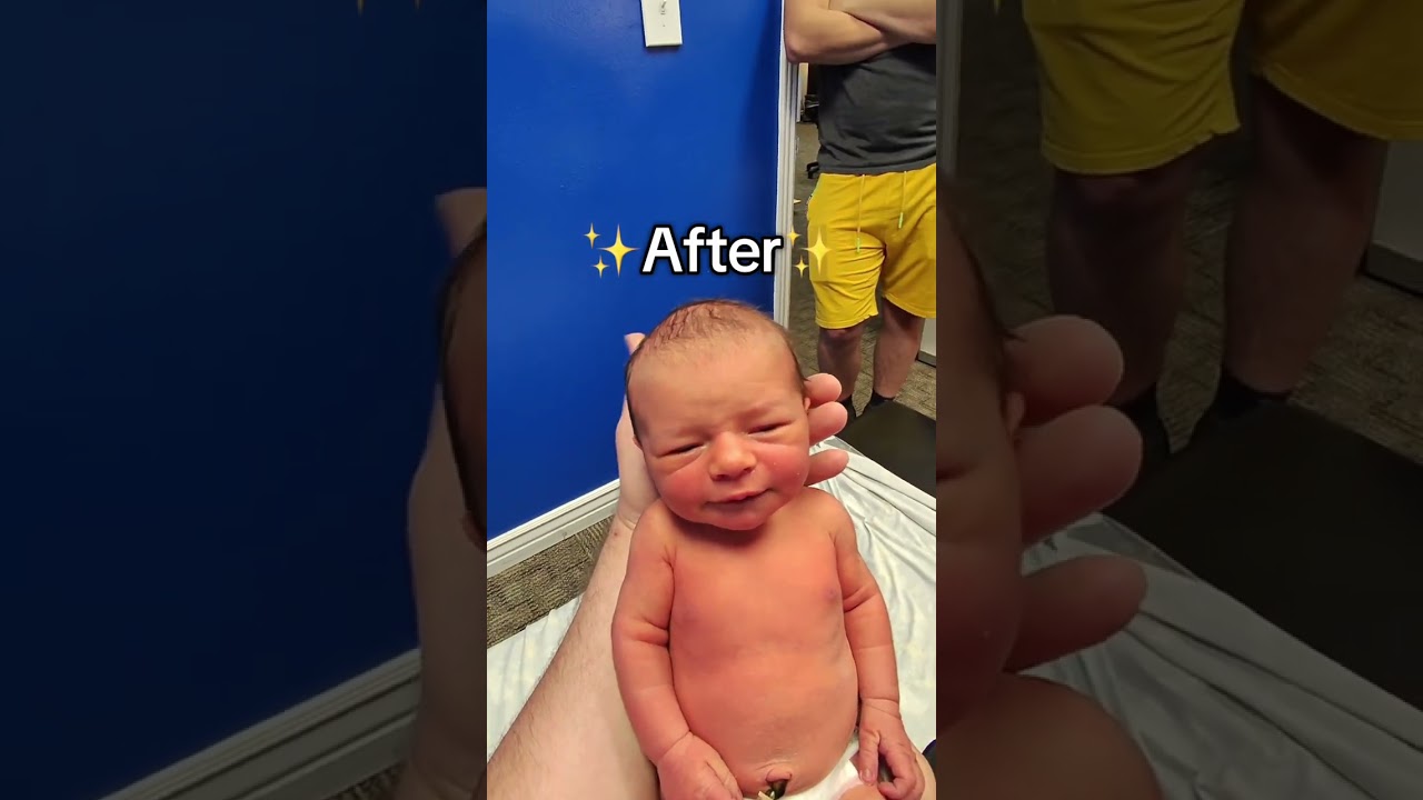 Before and after seeing the pediatric chiropractor! #baby