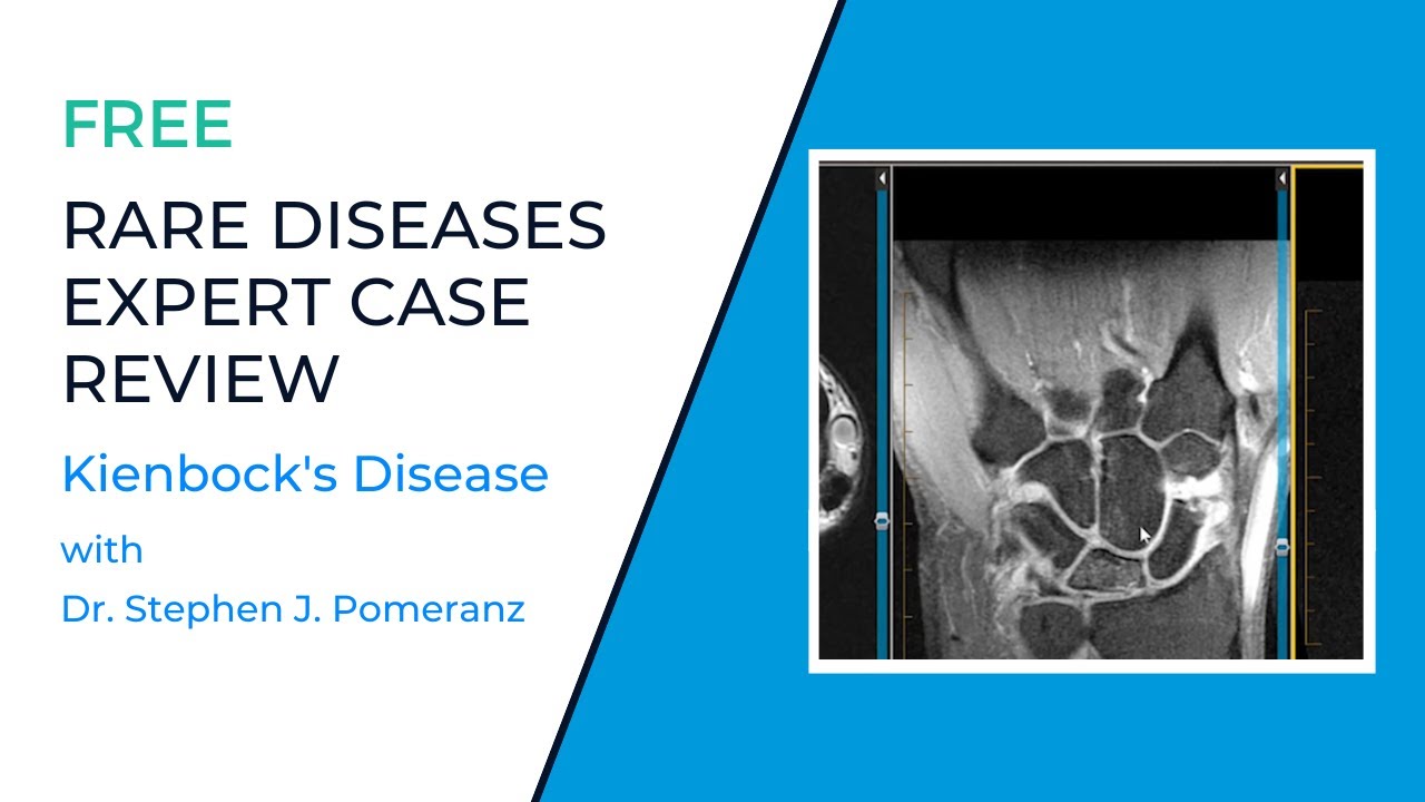 Rare Diseases Expert Case Review: Kienbock's Disease with Stephen J. Pomeranz, MD