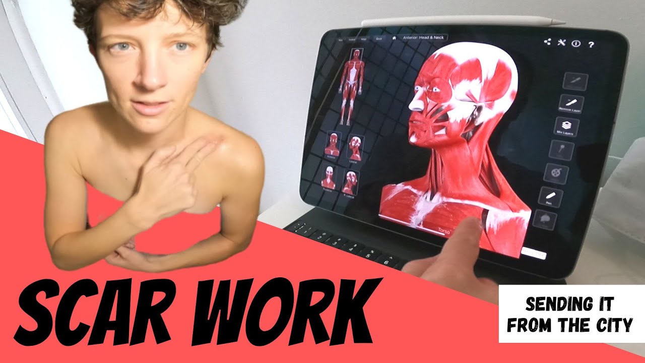 Broken Collarbone | Scar work