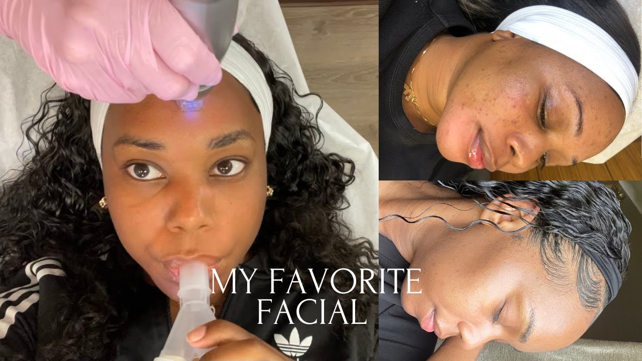 COME WITH ME TO GET A FACIAL✨ | RADIOFREQUENCY MICRONEEDLING + BEFORE AND AFTERS | ALL THINGS POLY