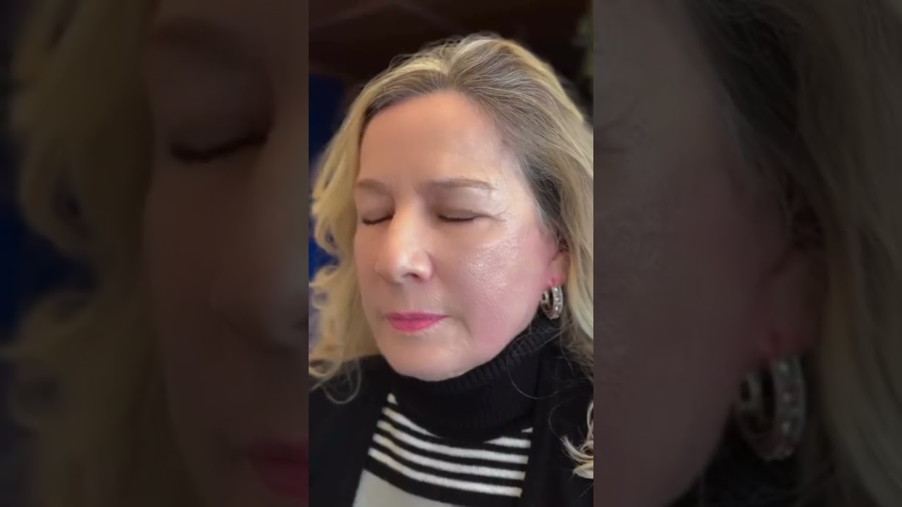 A m&aacute;gica da Line Skin com Dra. Tereza Scardua 😱✨, harmoniza&ccedil;&atilde;o facial!