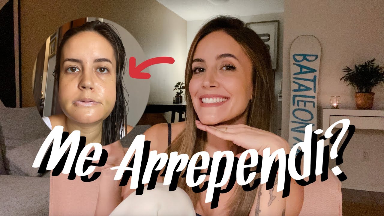 2 ANOS DE ORTOGNÁTICA - Alargamento do Nariz, Beijo, Parestesia & Auto Estima 💉