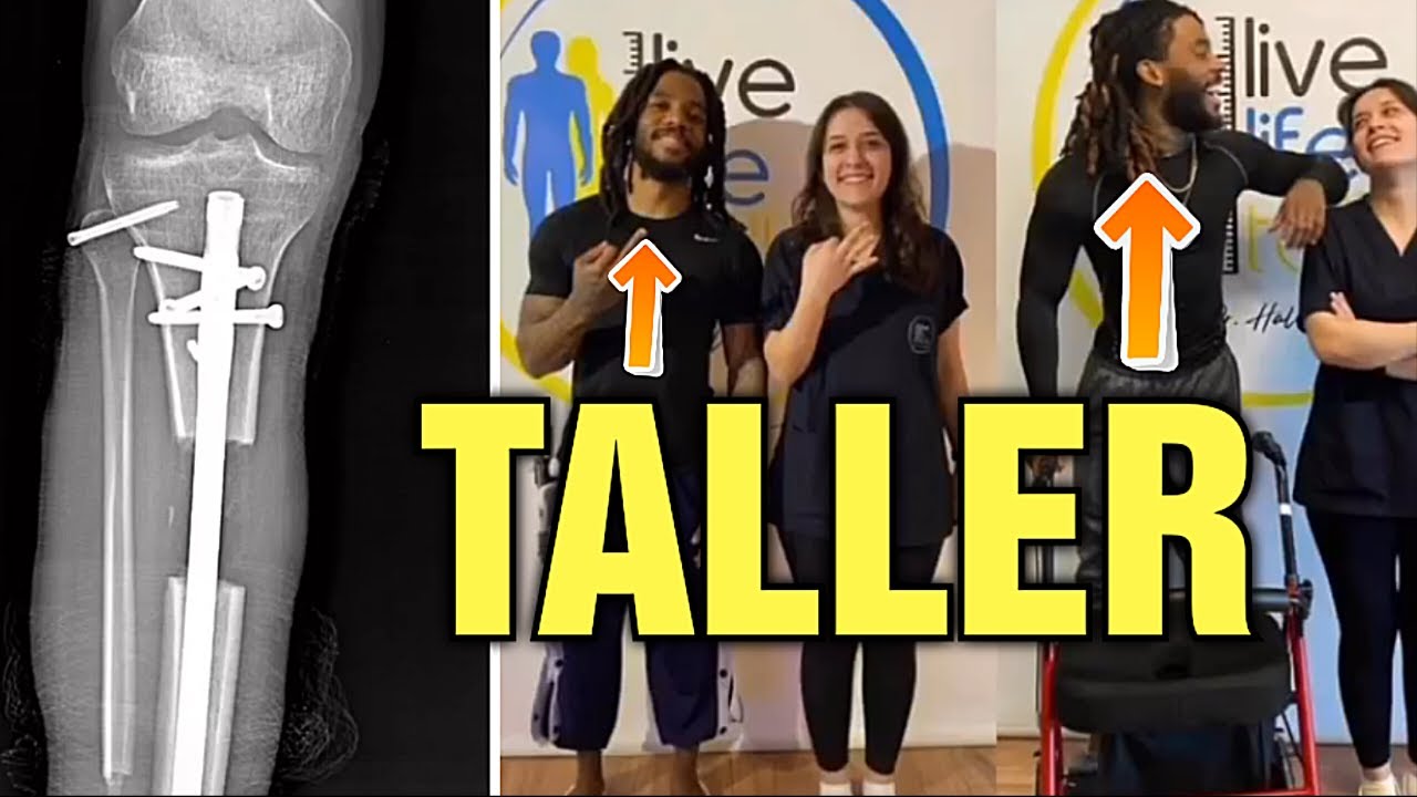 Mr Brokenbonez || Surgery To Be Taller