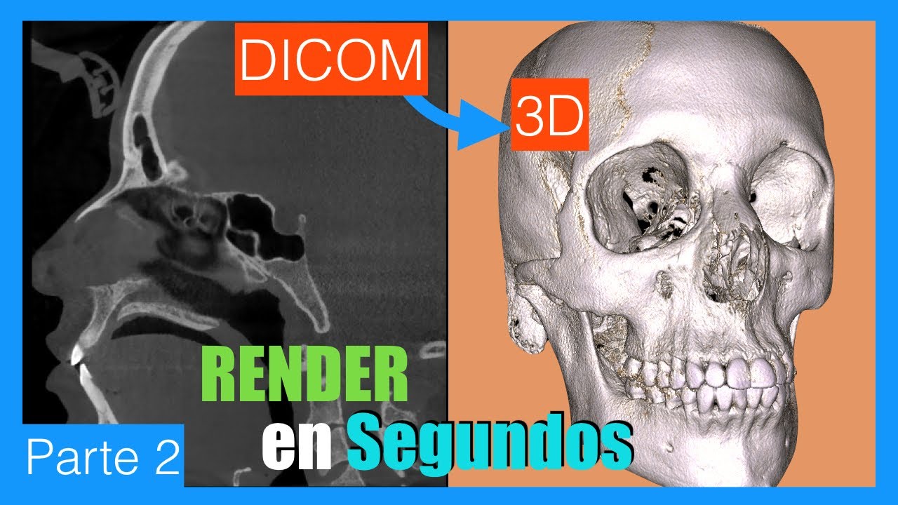 💰 Reconstrucción 3D de una tomografía con software GRATIS 💰 - Curso de 3D Slicer en ESPAÑOL parte 2