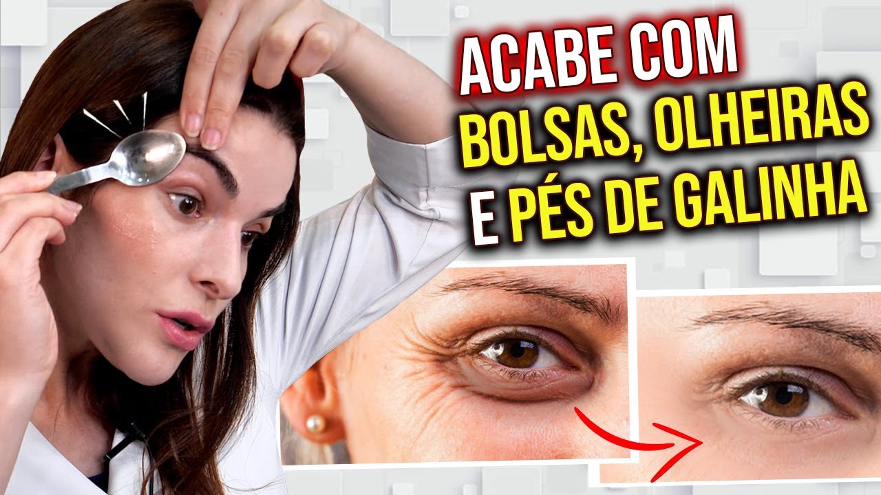 USE 1 COLHER e ACABE com Pés de Galinha, Bolsas e Olheiras 🥄