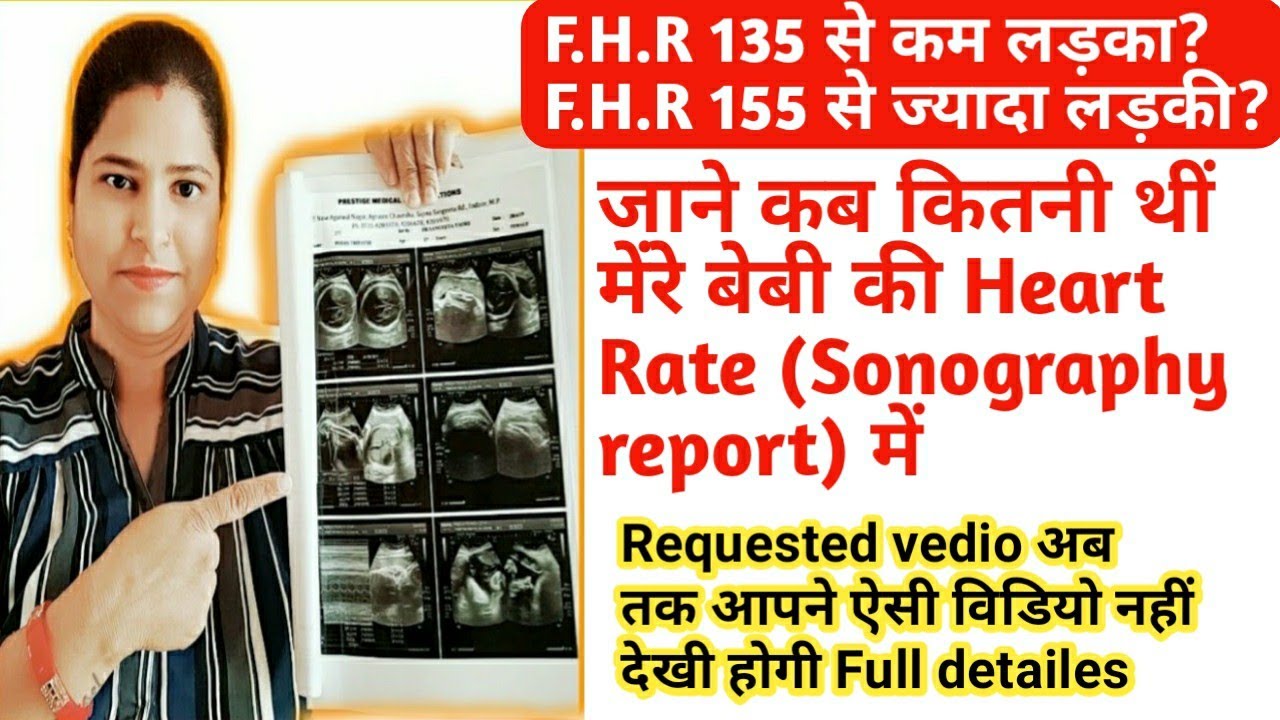 Myths and Facts|दिल की धड़कन(F.H.R)से क्या 101%जान सकते है कि होने वाला बच्चा क्या होगा?baby gender|