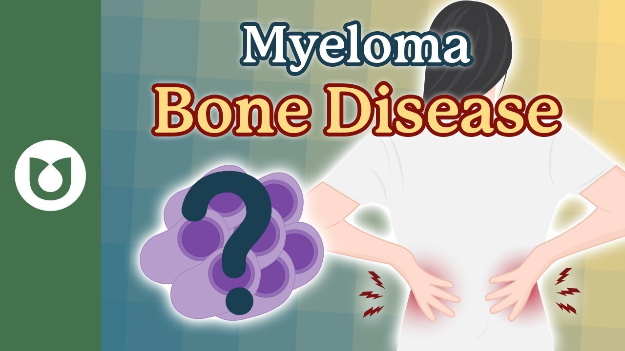 What is myeloma bone disease? #myeloma