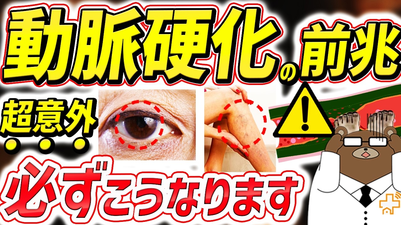 【危険】知らないと後悔する。目・首・足..全身で動脈硬化が進行すると起きる要注意な危険サイン。血管が詰まる寸前必ずこうなる。動脈硬化を防ぐ術はないのか。医師が完全解説。
