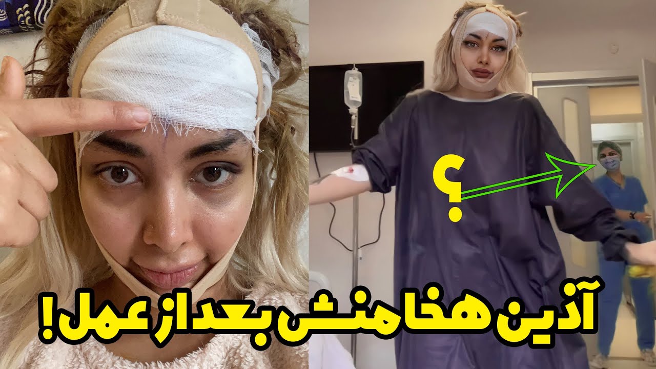 بالاخره گفتم که جه عمل هایی کردم 😳 اصلا چی شدش عمل کردم !؟