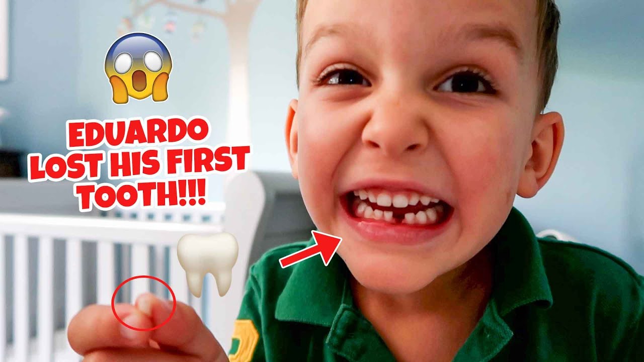 EDUARDO LOST HIS FIRST TOOTH!!