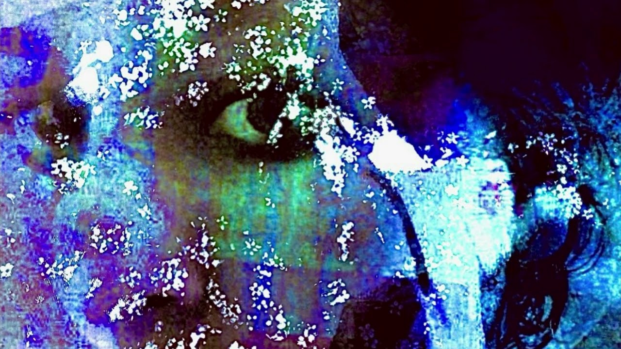 Frostbite