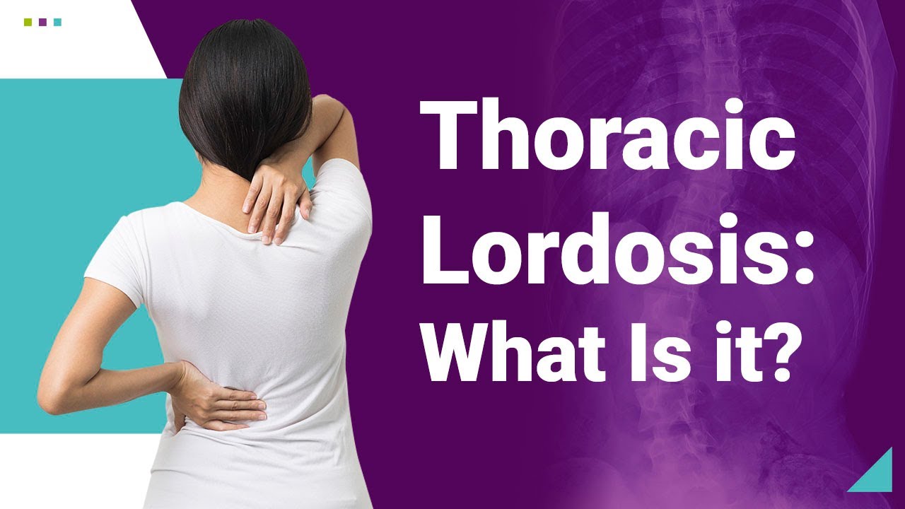Thoracic Lordosis: What Is it?