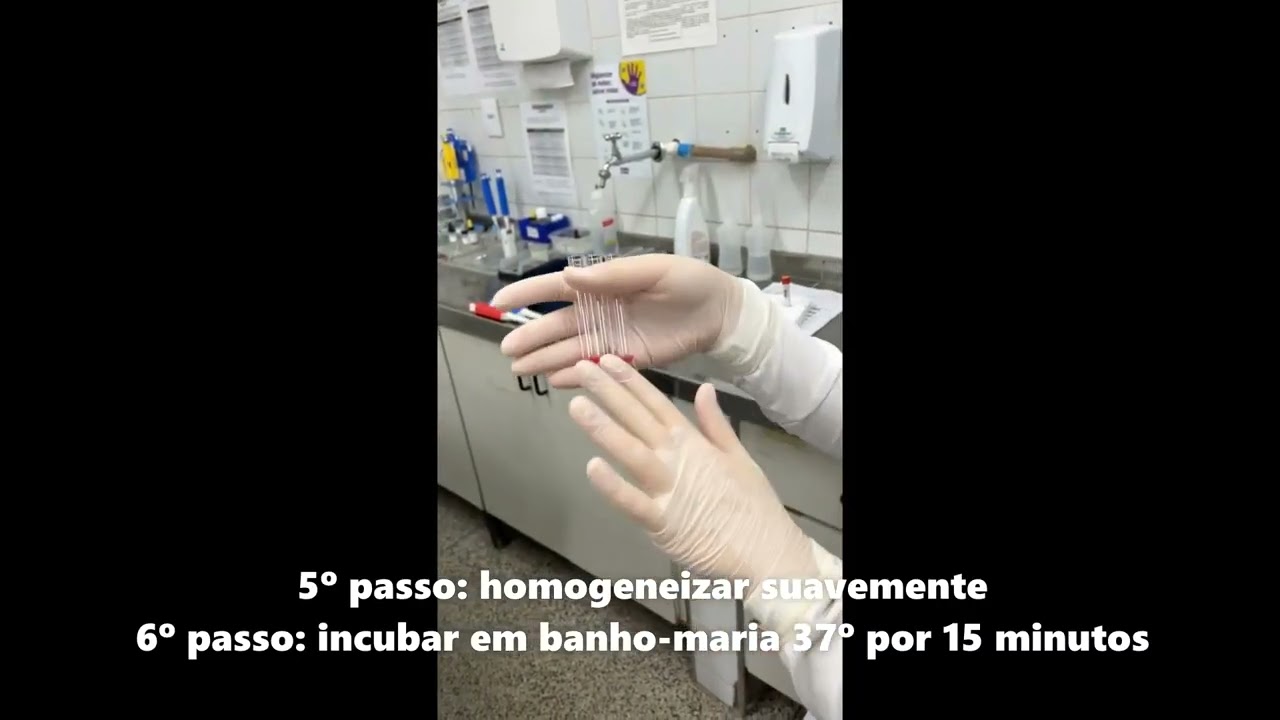 Técnica de Du   D Fraco   Técnica Tubo