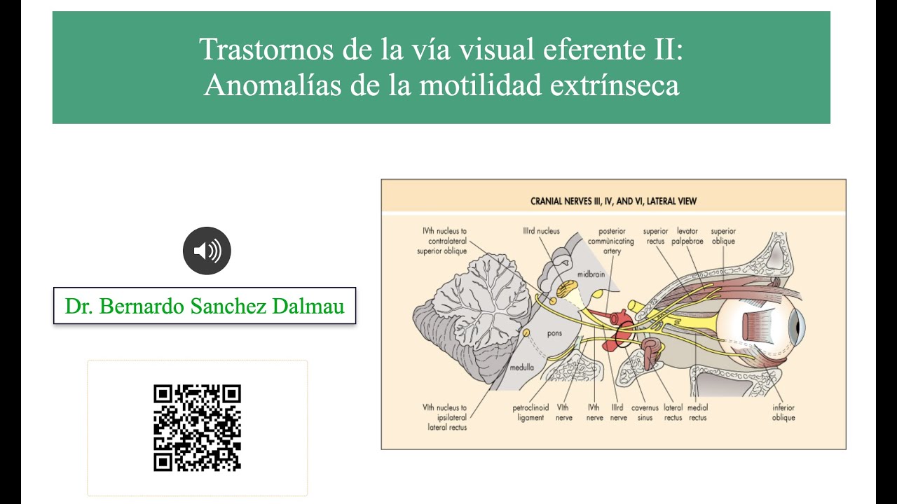 Trastornos de la Vía Visual Eferente II. Anomalías de la Motilidad Ocular Extrínseca.