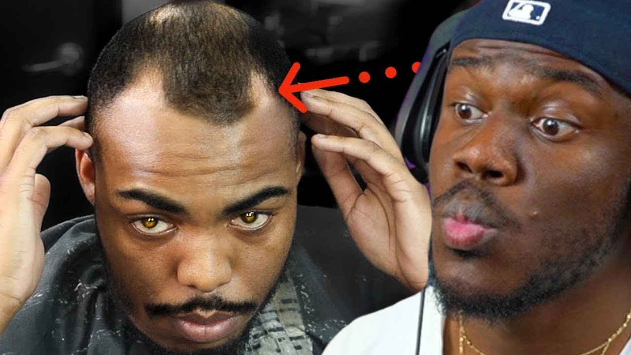 Barber Fixes His Clients Bald Spots! Gives Him A Bald Fade