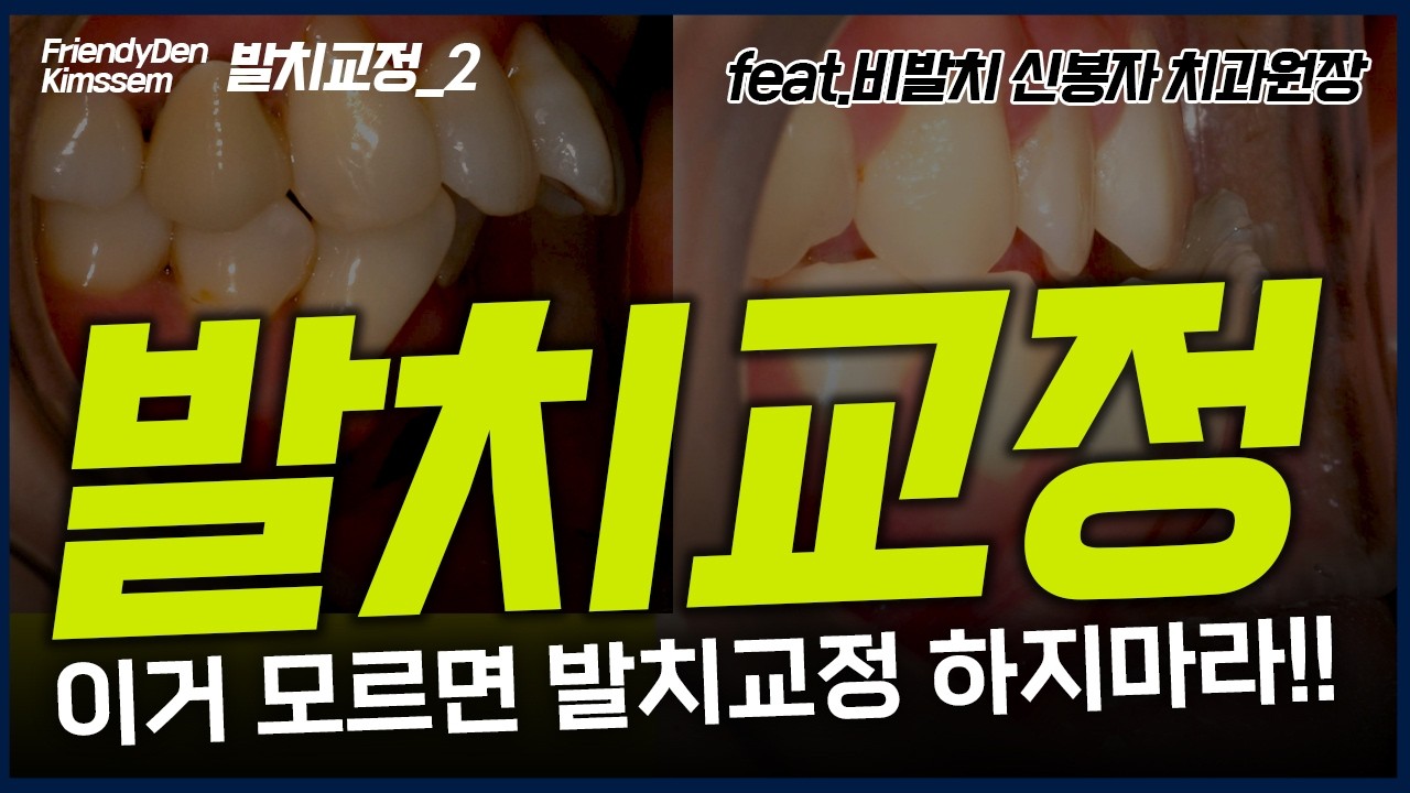 발치교정 !! 이거 모르면 망하게 되는 5가지 이유 ( #발치교정 #교정전문의 #비발치교정 #아인스치과 #덧니교정 #앞니교정 #치아교정부작용 )