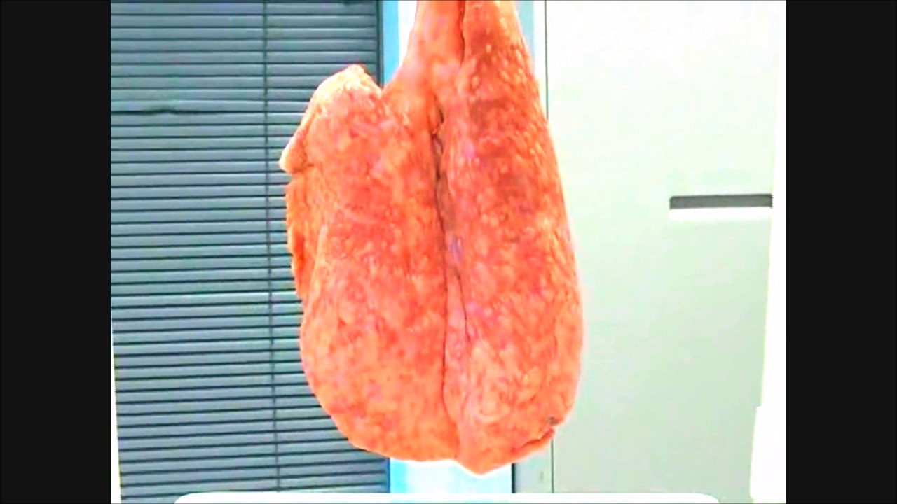 Ventilation with self Inflating bag