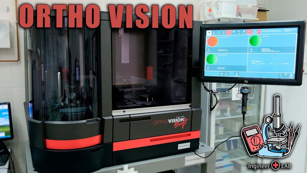 ORTHO VISION