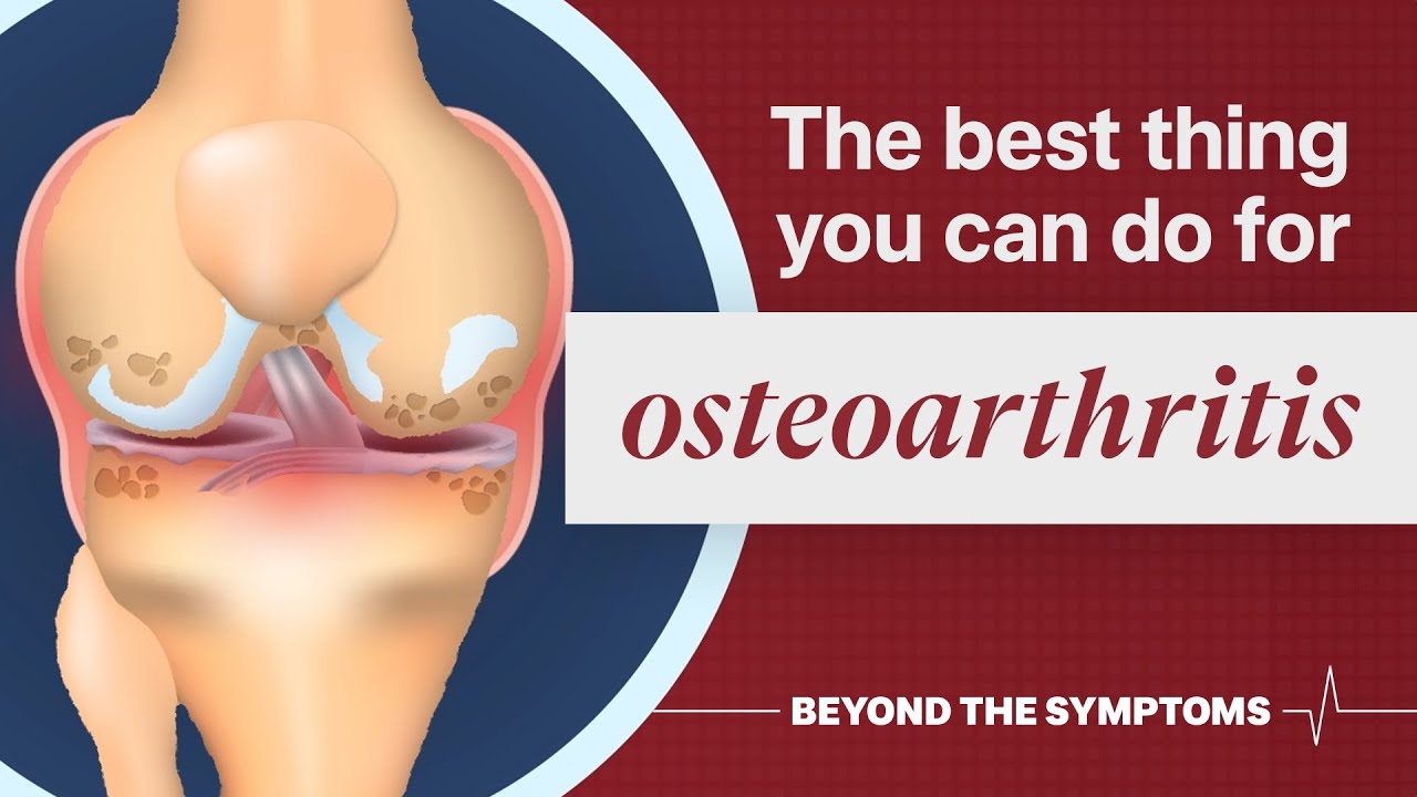 How to treat osteoarthritis