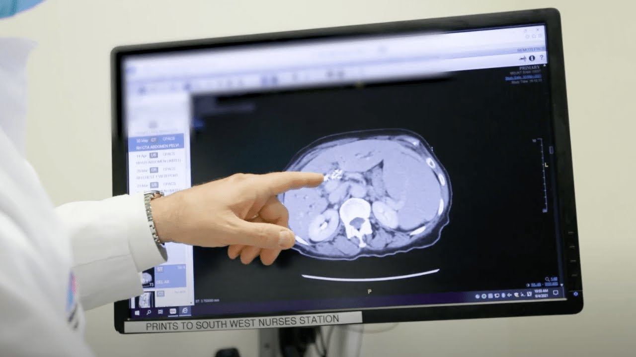 Center of Excellence: Liver and Bile Duct Cancer