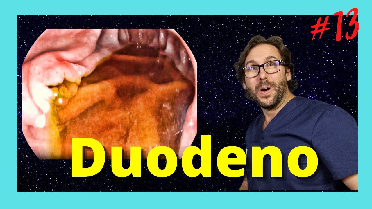 🧐 ENDOSCOPIA en DUODENO te resumo lo + TOP 💥. CURSO ENDOSCOPIA PRINCIPIANTES & RESIDENTES#13🚀.