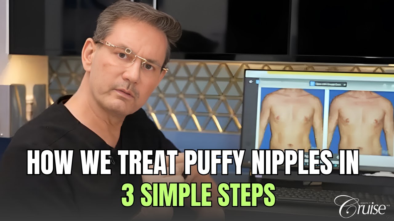 How to treat male puffy nipples   gynecomastia