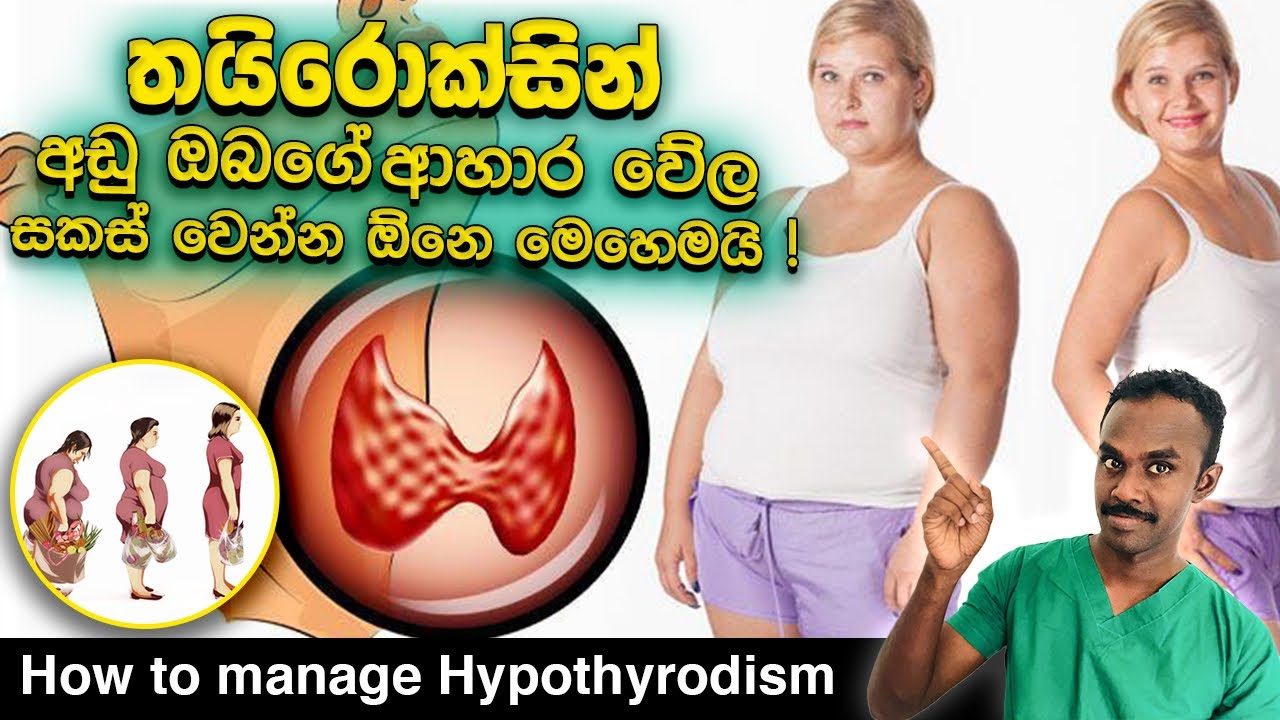 හයිපර්තයිරොඩිසම් රෝග තත්වය නිසා සිදුවන තරබාරුකම පාලනය කරගන්නෙ කොහොමද? | How to manage Hypothyrodism
