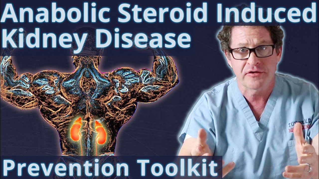 Steroid Induced Kidney Disease - Prevention Toolkit
