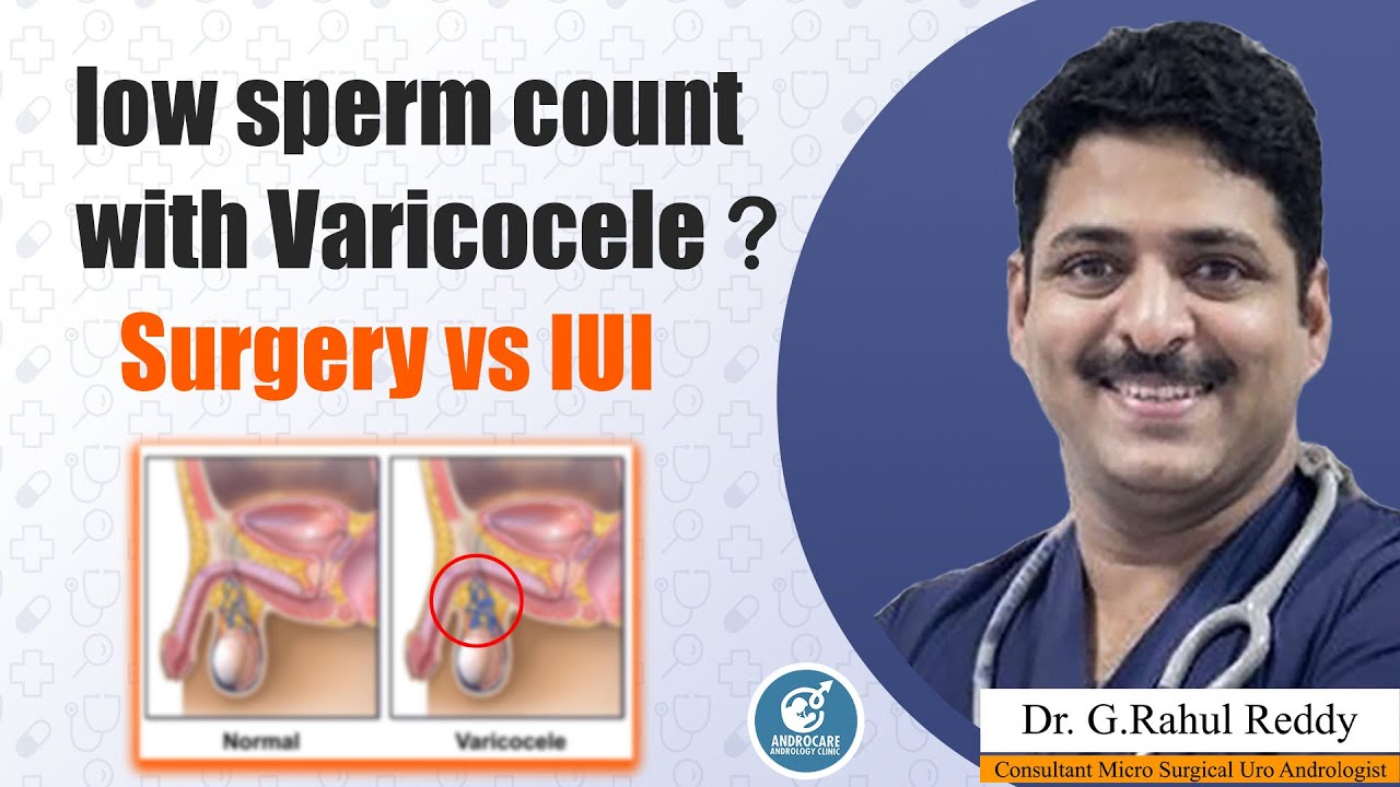 Low Sperm Count With Varicocele Surgery vs IUI || Dr Rahul Reddy || Androcare Andrology Institute