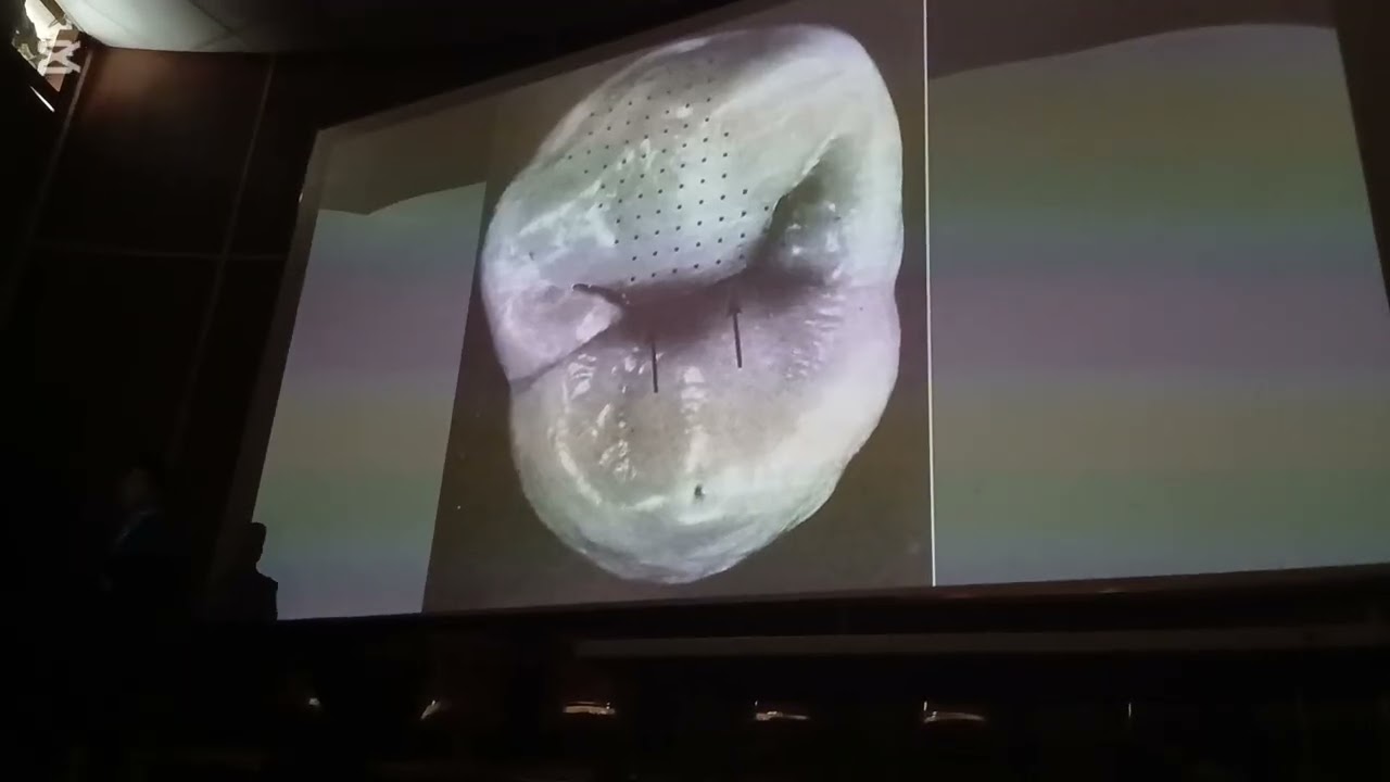 Clase teorica de anatomia dentaria 23/02/26