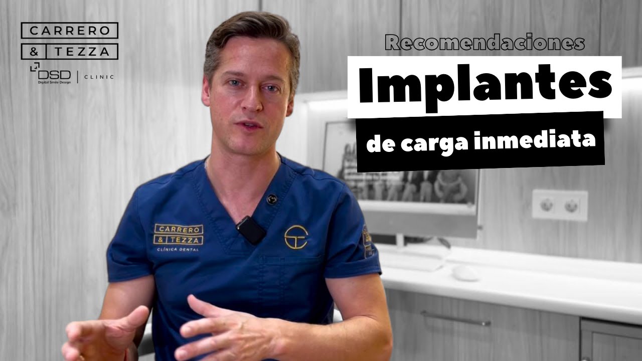 Recomendaciones Implantes de Carga Inmediata
