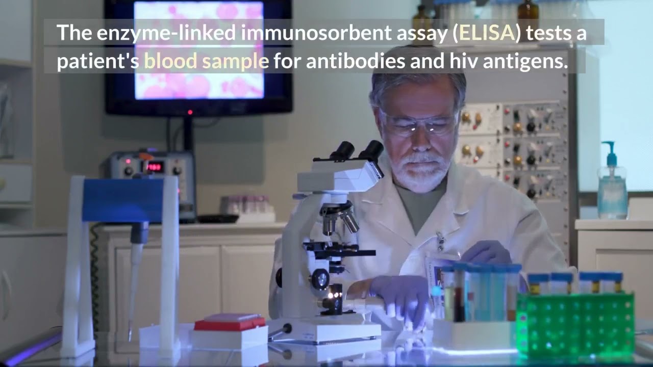 Czym jest test Elisa na obecność wirusa HIV?