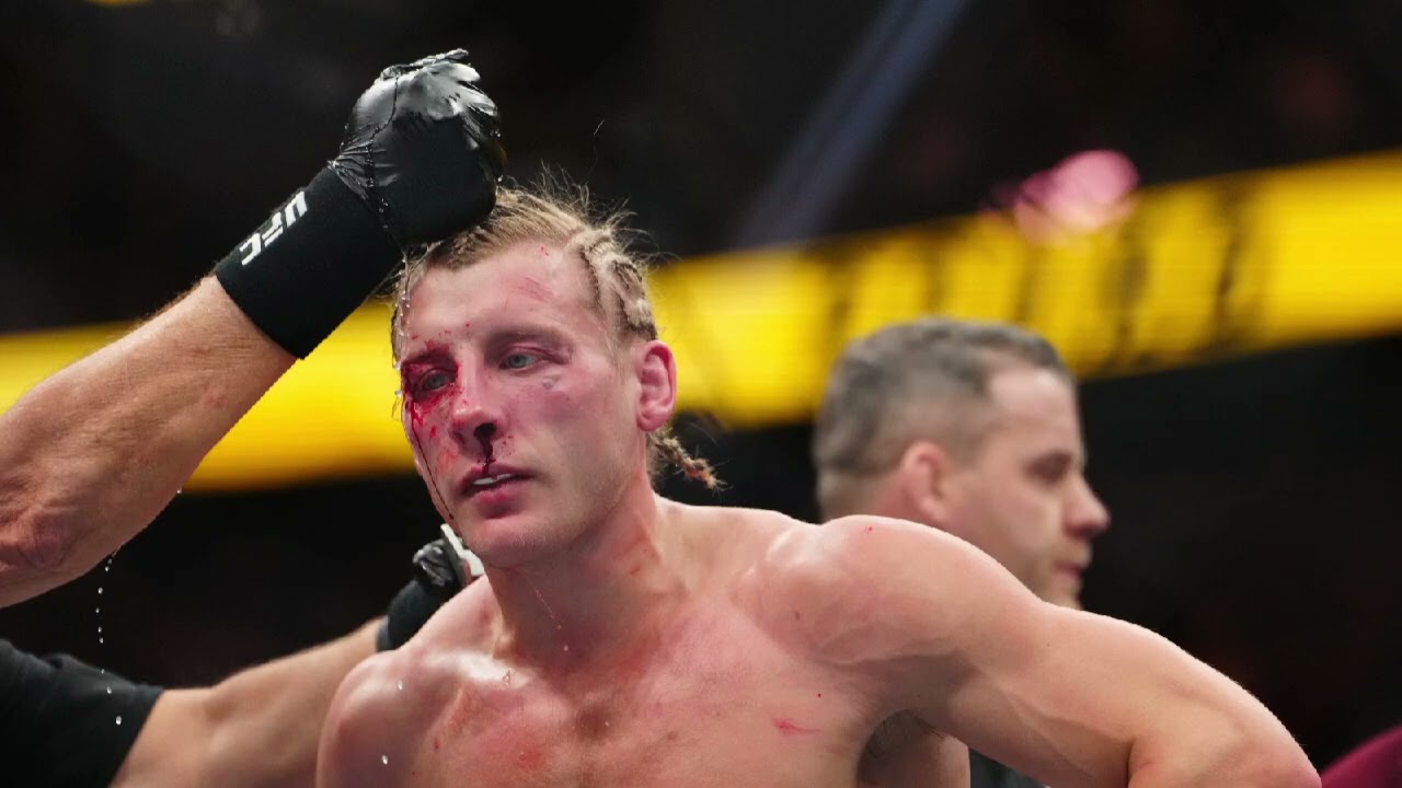 Paddy Pimblett Blames Justin Gaethje Foul for UFC 324 Injury | Latest Update 🥊🔥
