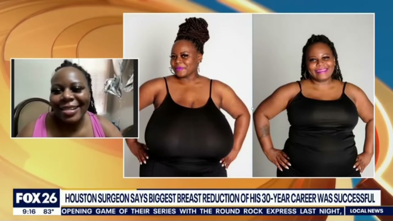 Top Houston Plastic Surgeon | Breast Reduction | Dr Franklin Rose | Secrets of Dr. Rose Success