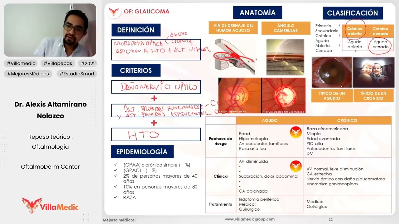 GLAUCOMA - CRITERIOS - CLASIFICACIÓN - OFTALMOLOGÍA - VILLAMEDIC