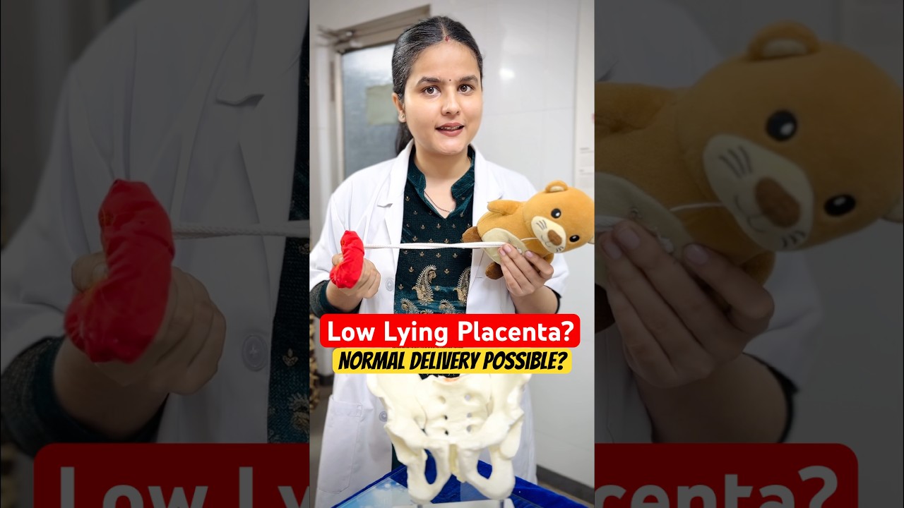 आंवल नीचे है (Low Lying Placenta) , नार्मल डिलीवरी हो सकती है ? Placenta Previa explained in Hindi