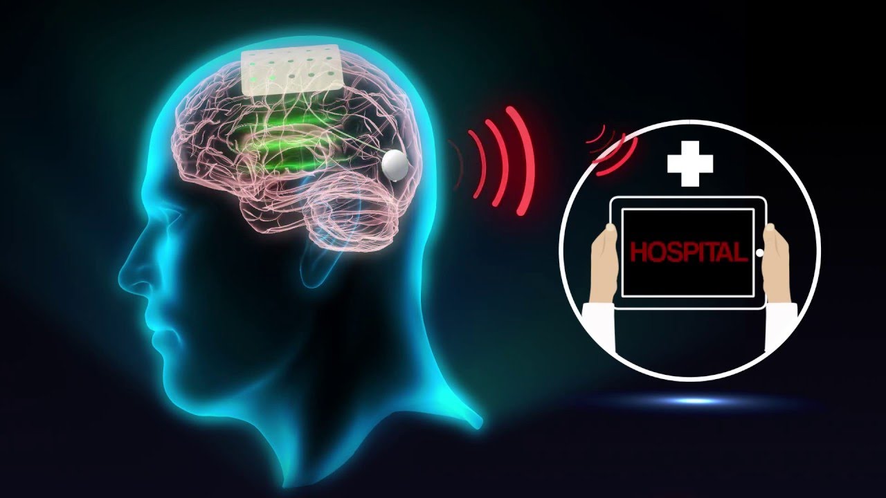Graphene-based sensors for biomedicine and brain-machine interfaces (MWC 2016)