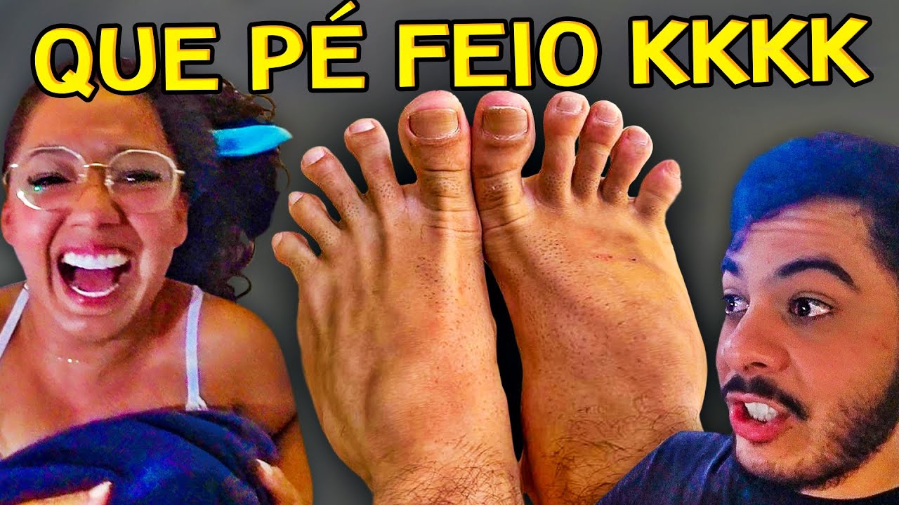 Fui atacado por PERNILONGOS e fiquei com os PÉ MUITO INCHADO kkkkkk