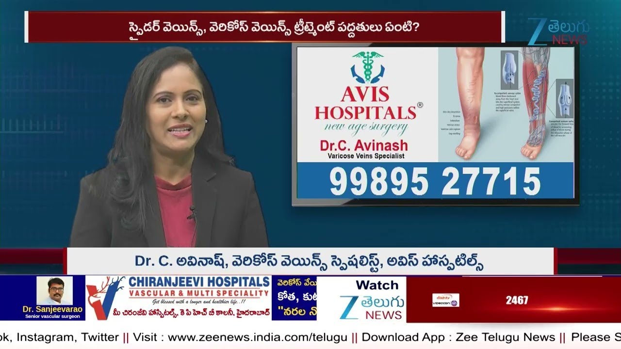 Expert Doctor Explains Varicose Veins: Symptoms, Causes & Treatment