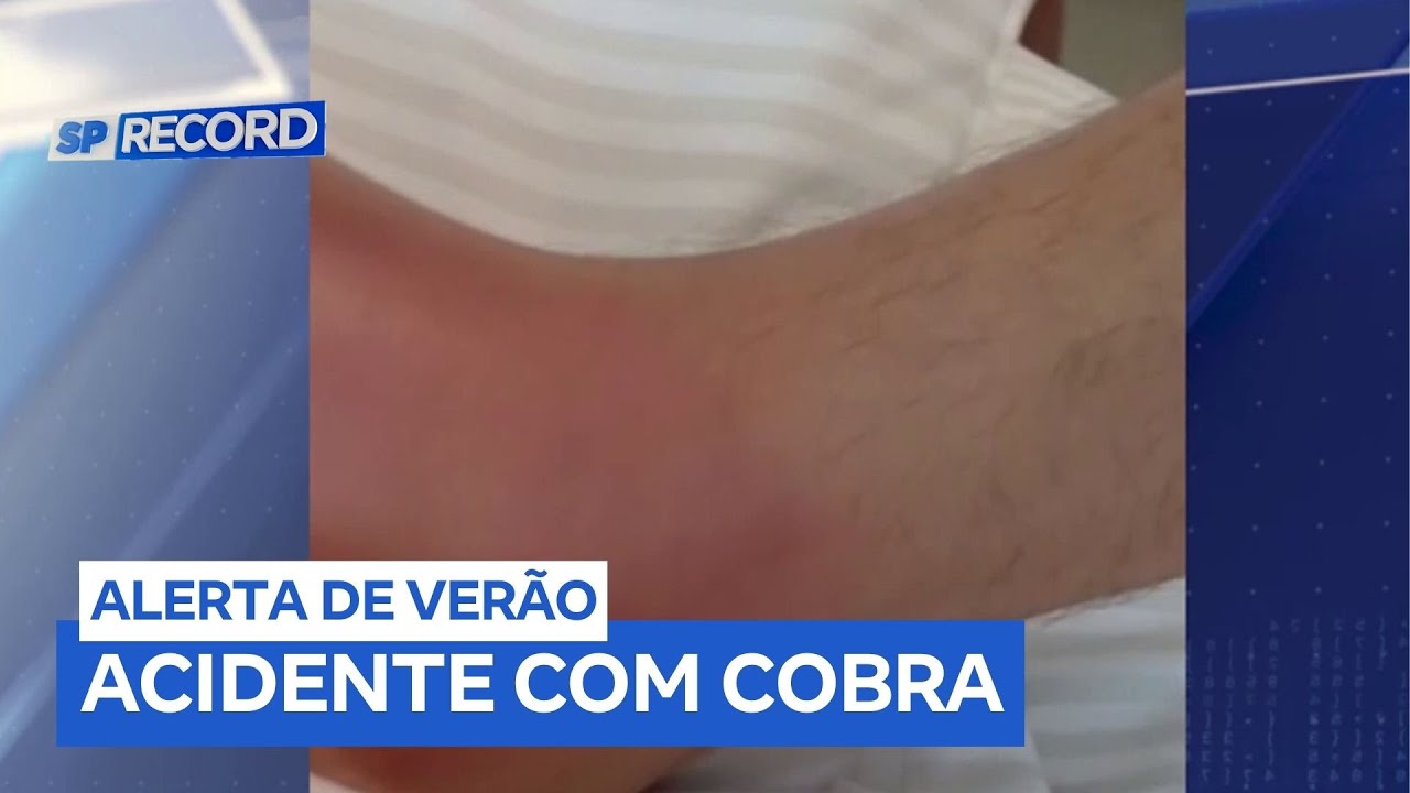 Adolescente é picado por jararaca em jardim de condomínio de São Sebastião (SP)