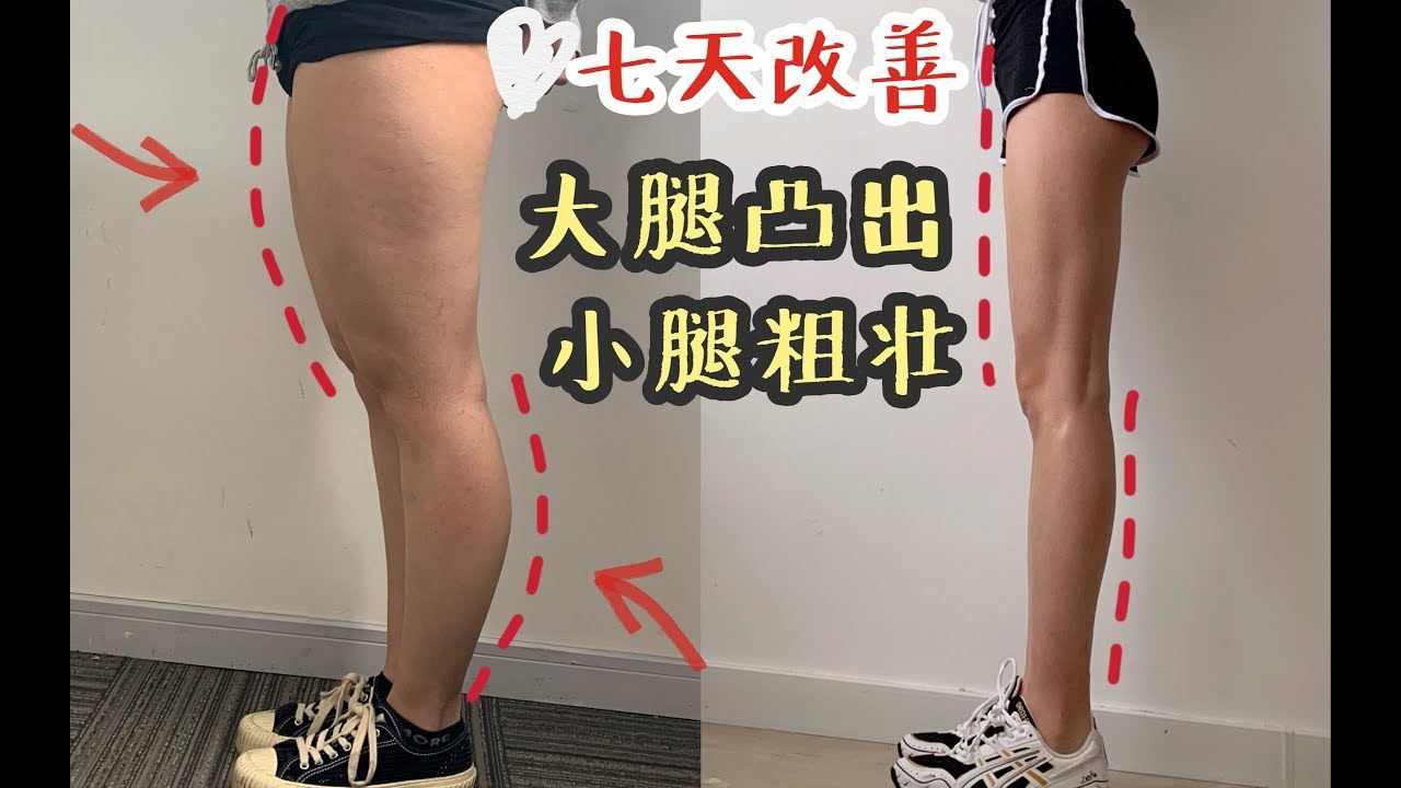 大腿前侧粗壮凸出小腿肚向后突出腿形不直必练一周见效的教程！