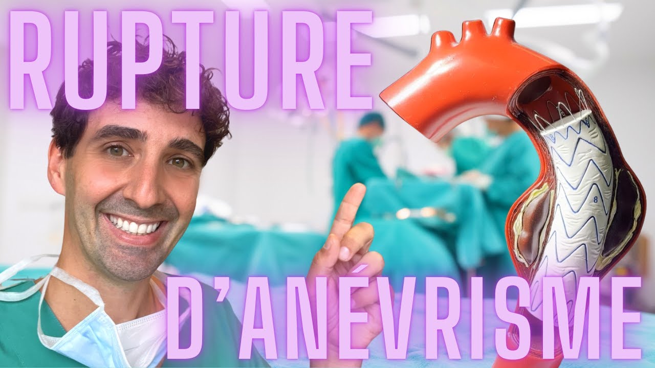 RUPTURE d'ANEVRISME de l’AORTE : ce que tu dois absolument savoir !