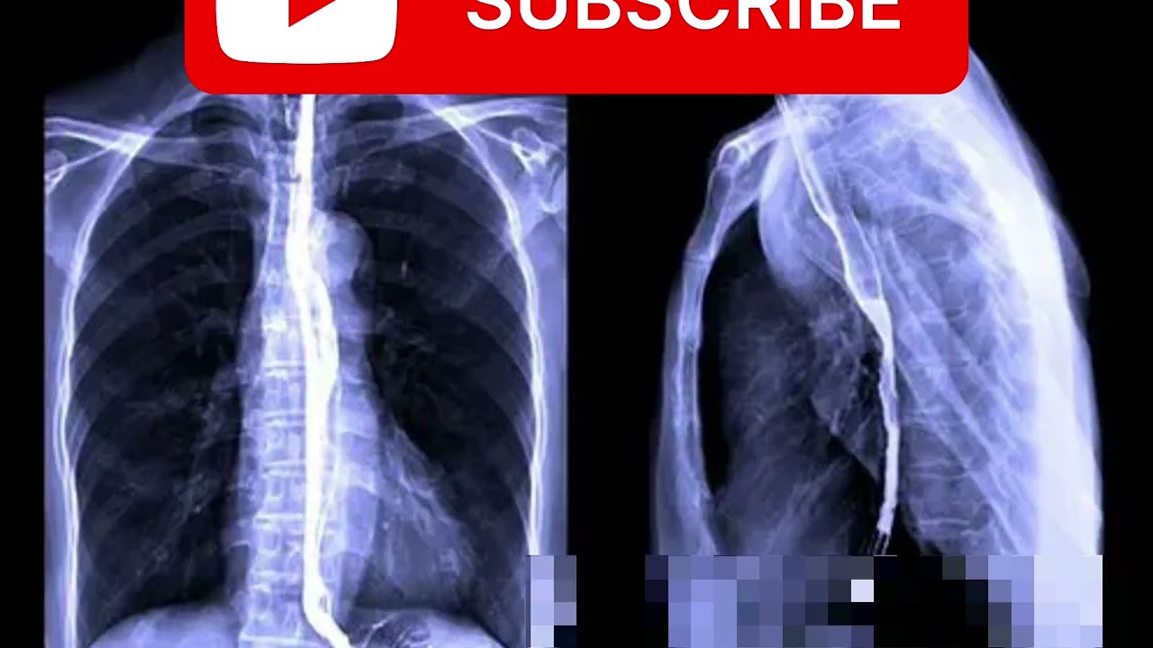 X-RAY PROCEDURE 