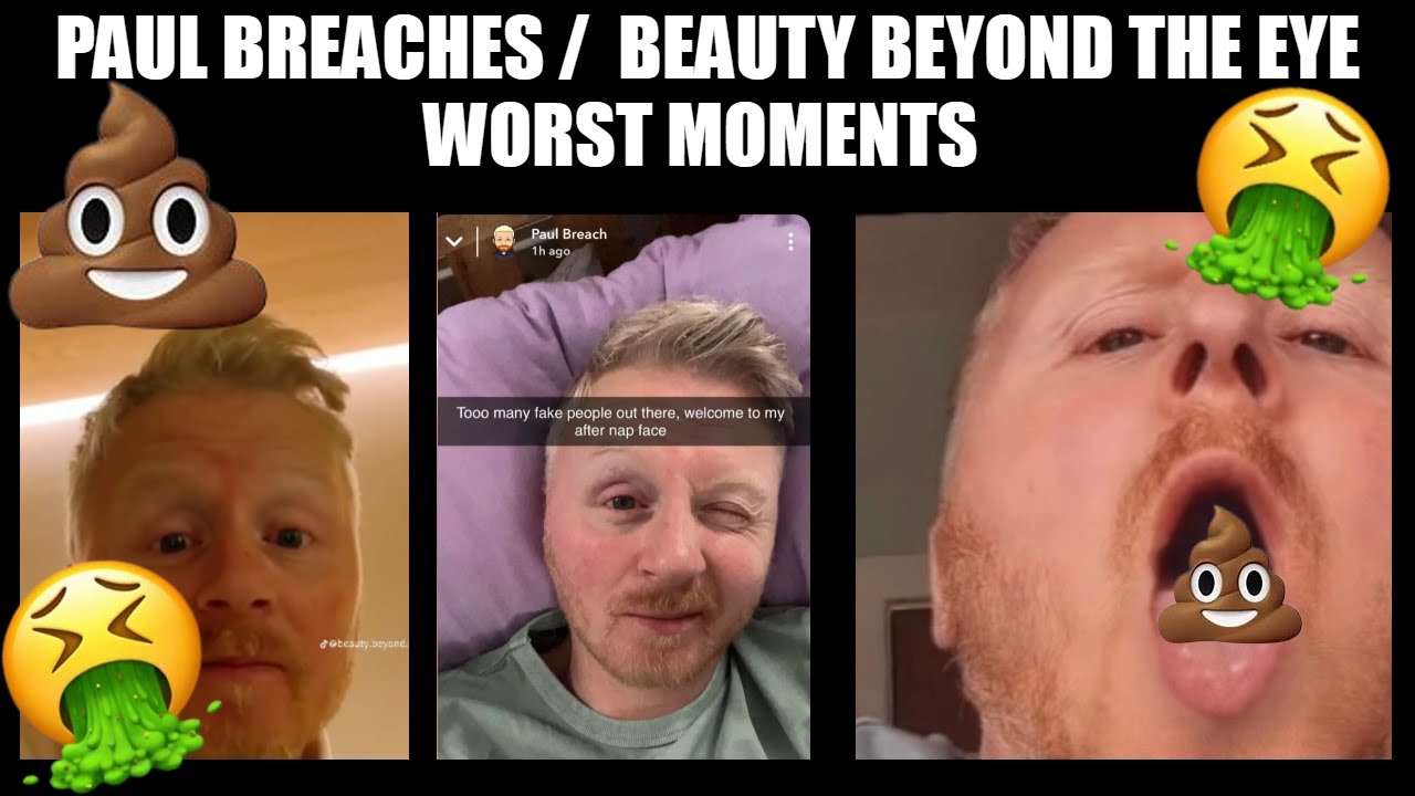 paul breach must be stopped